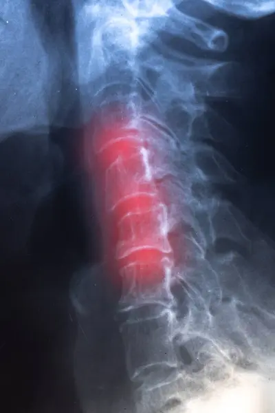 Chiropractic Care for Pregnancy Indianapolis